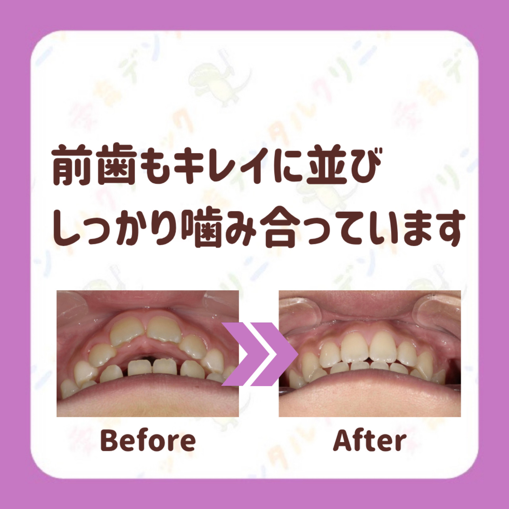 矯正症例