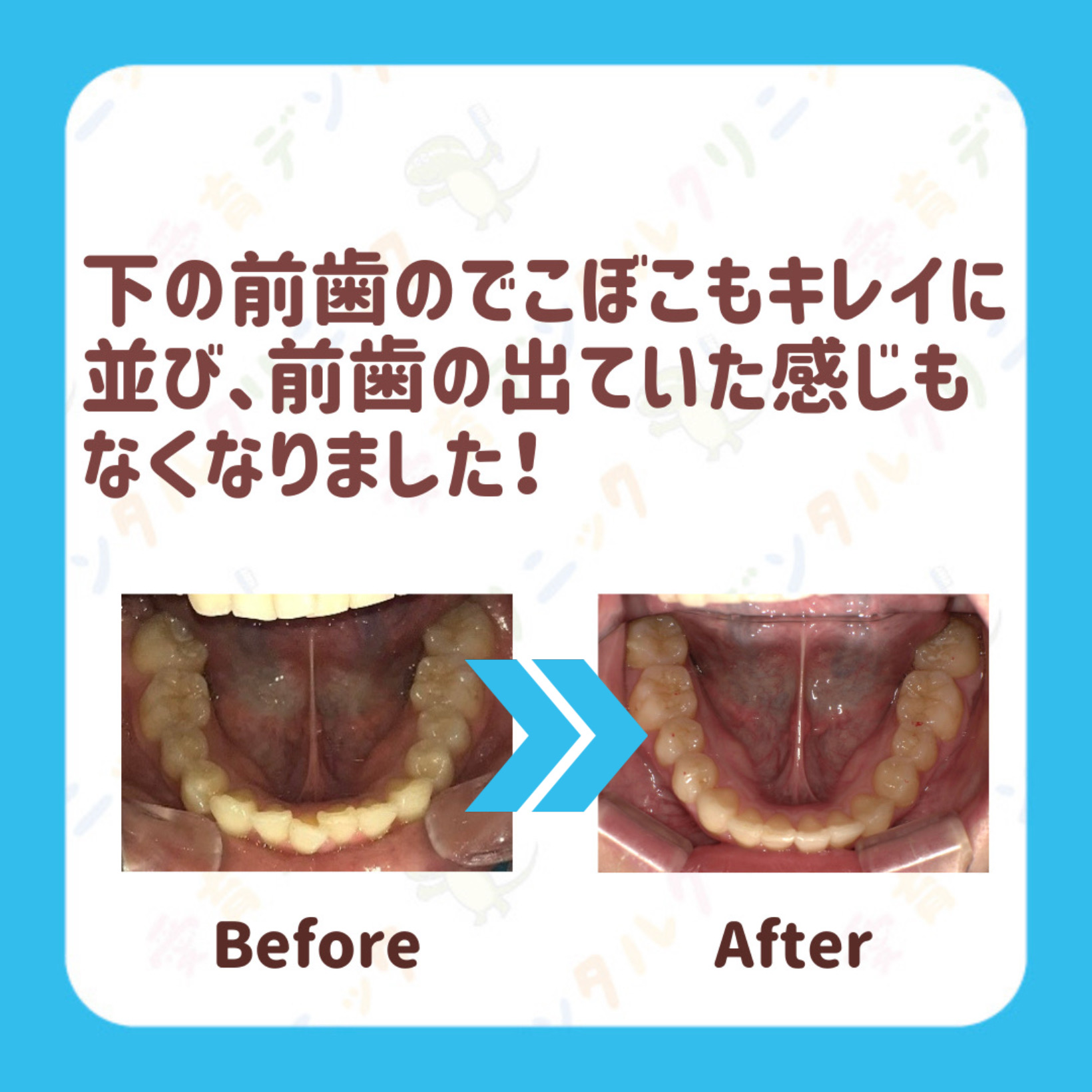矯正症例