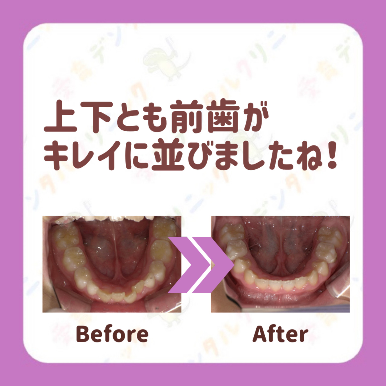 矯正症例