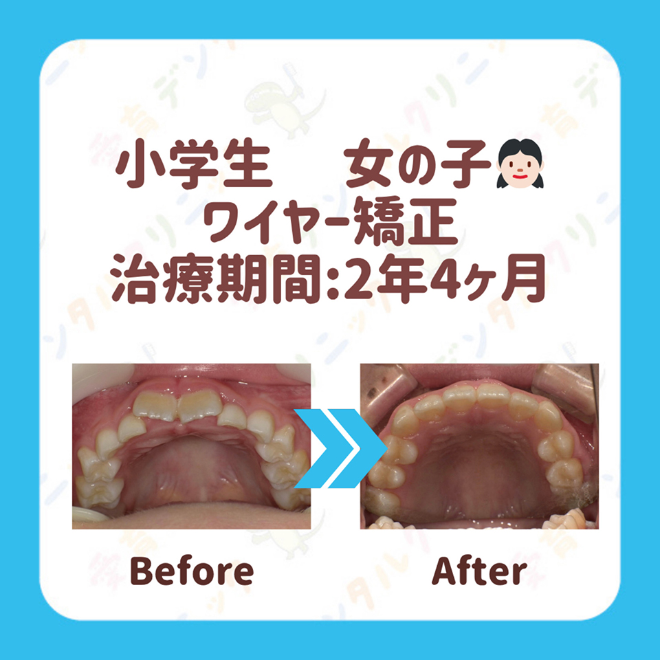 矯正症例