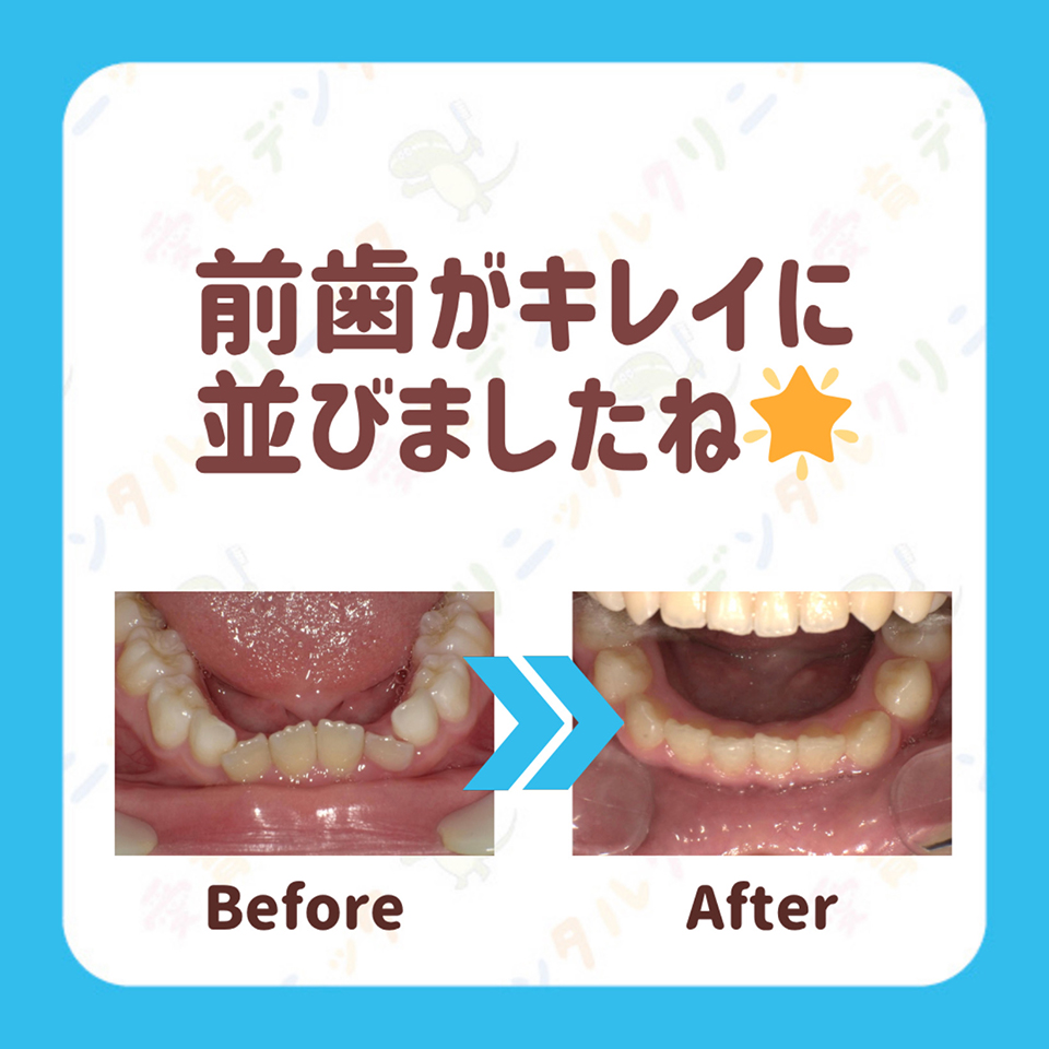 矯正症例