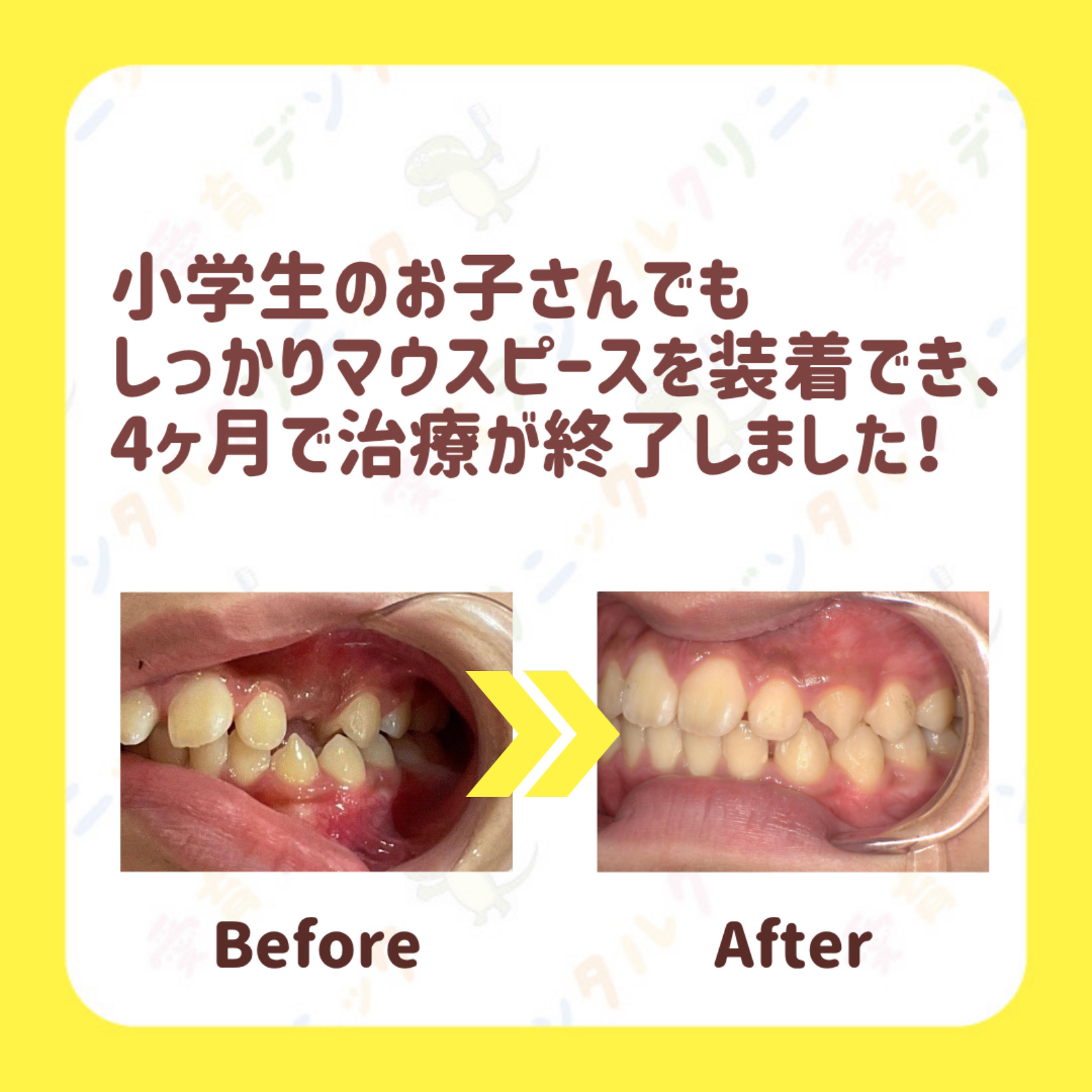 矯正症例