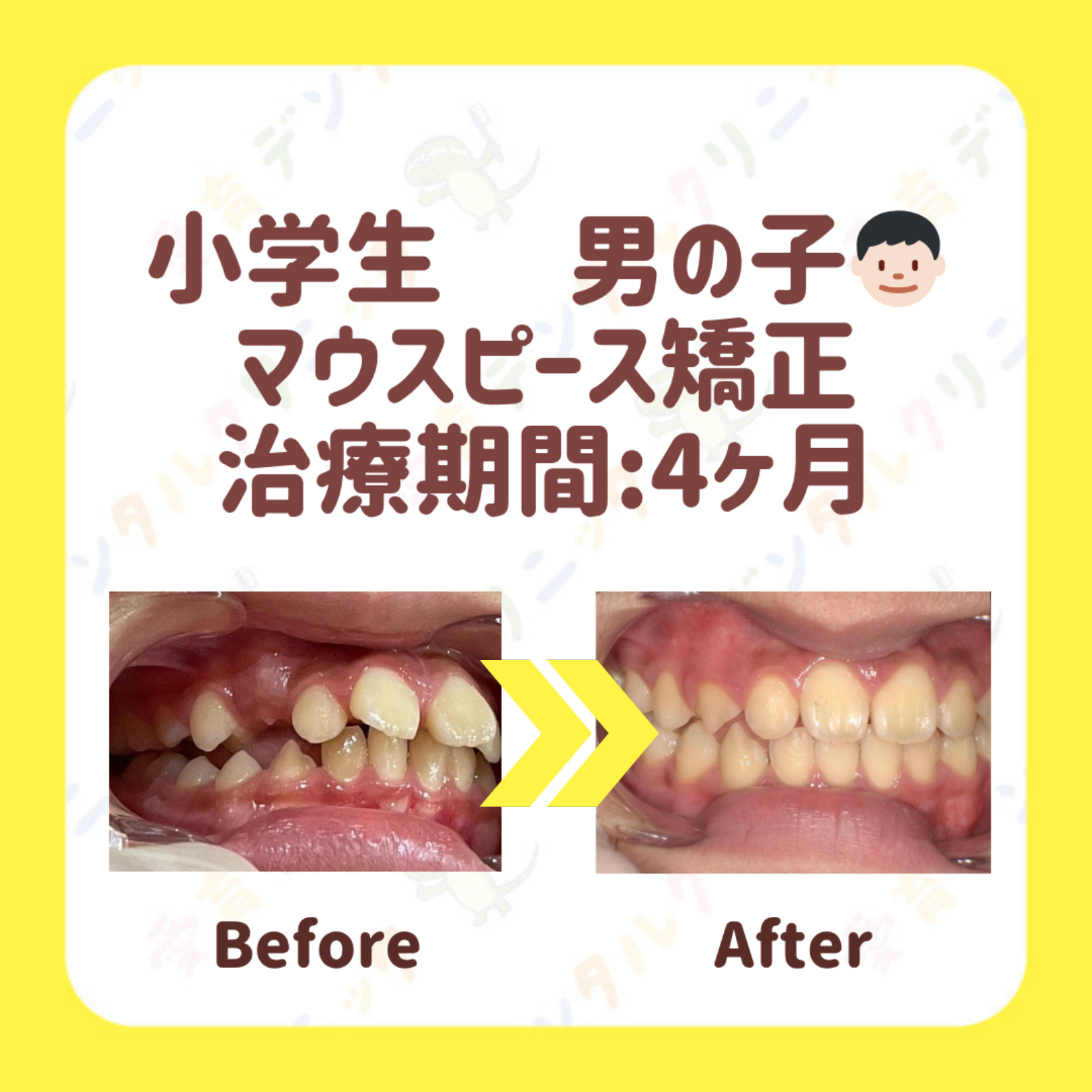 矯正症例