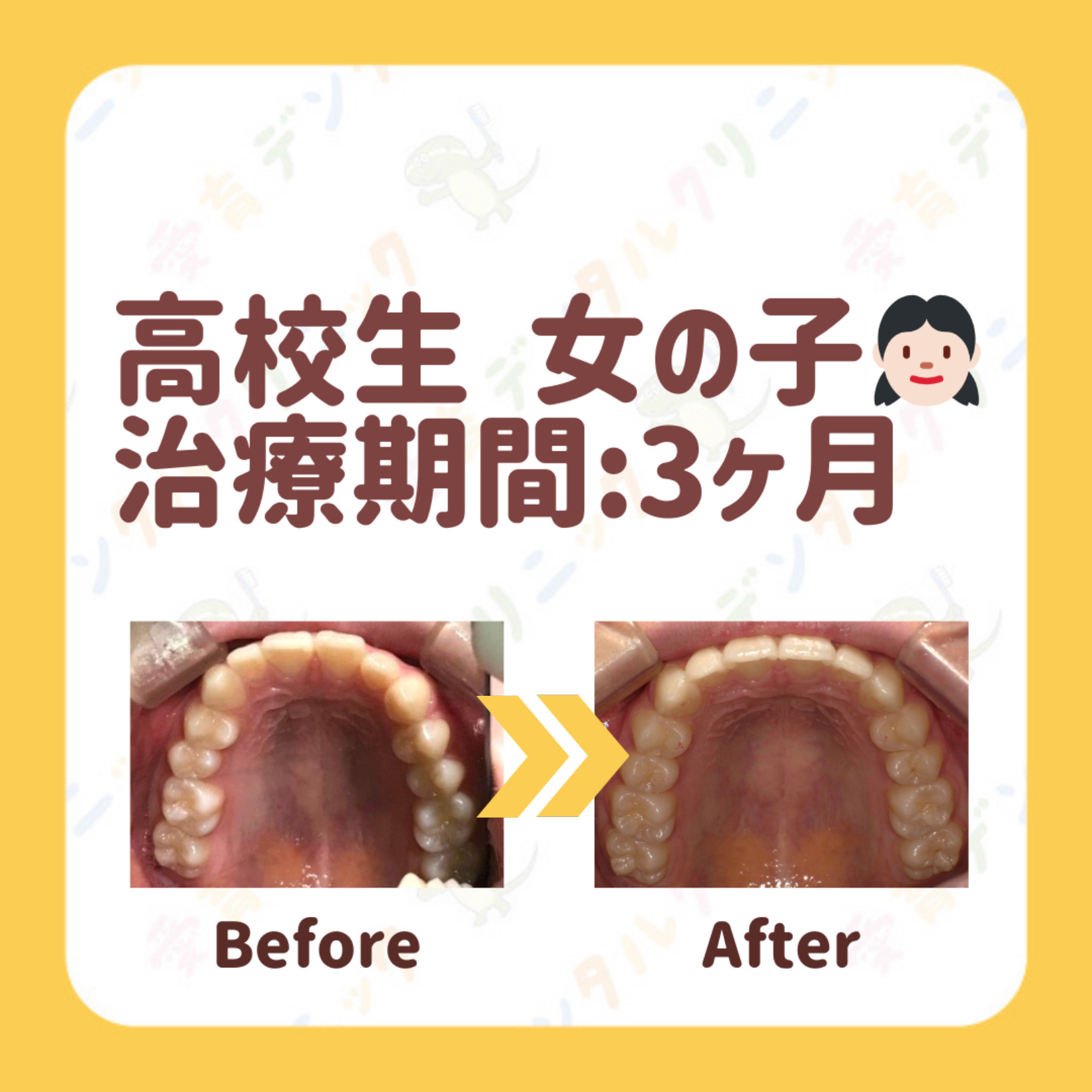 矯正症例