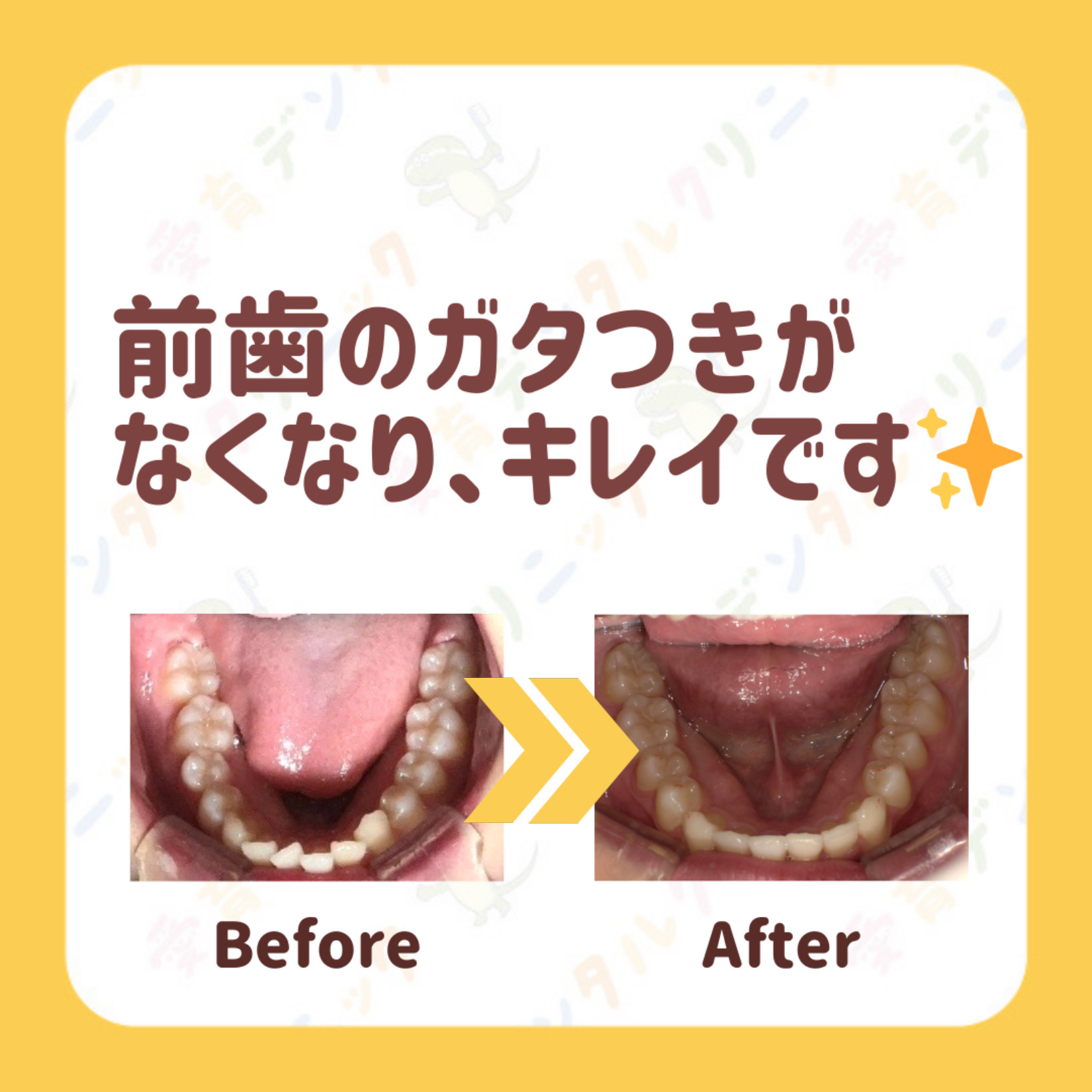矯正症例