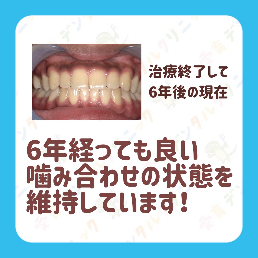 矯正症例